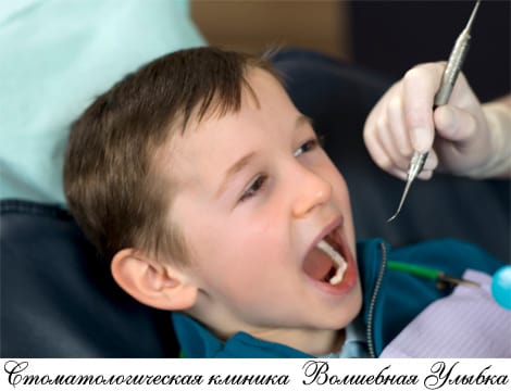 Герметизация зубов у детей – действенный метод профилактики кариеса