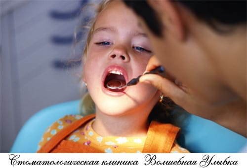 Реминерализация зубов у детей – эффективное средство профилактики и лечения детского кариеса
