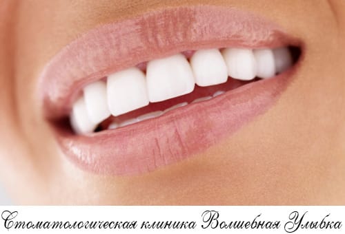 Бюгельное протезирование зубов: эффективно, эстетично, недорого!