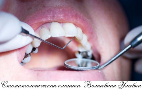 Профгигиена зубов полости рта