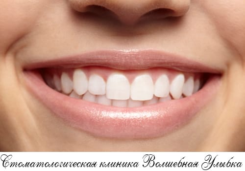 Синус-лифтинг – отличный шанс иметь красивые зубы!