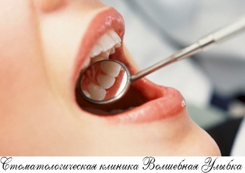Установка, фиксация протезов на зубы